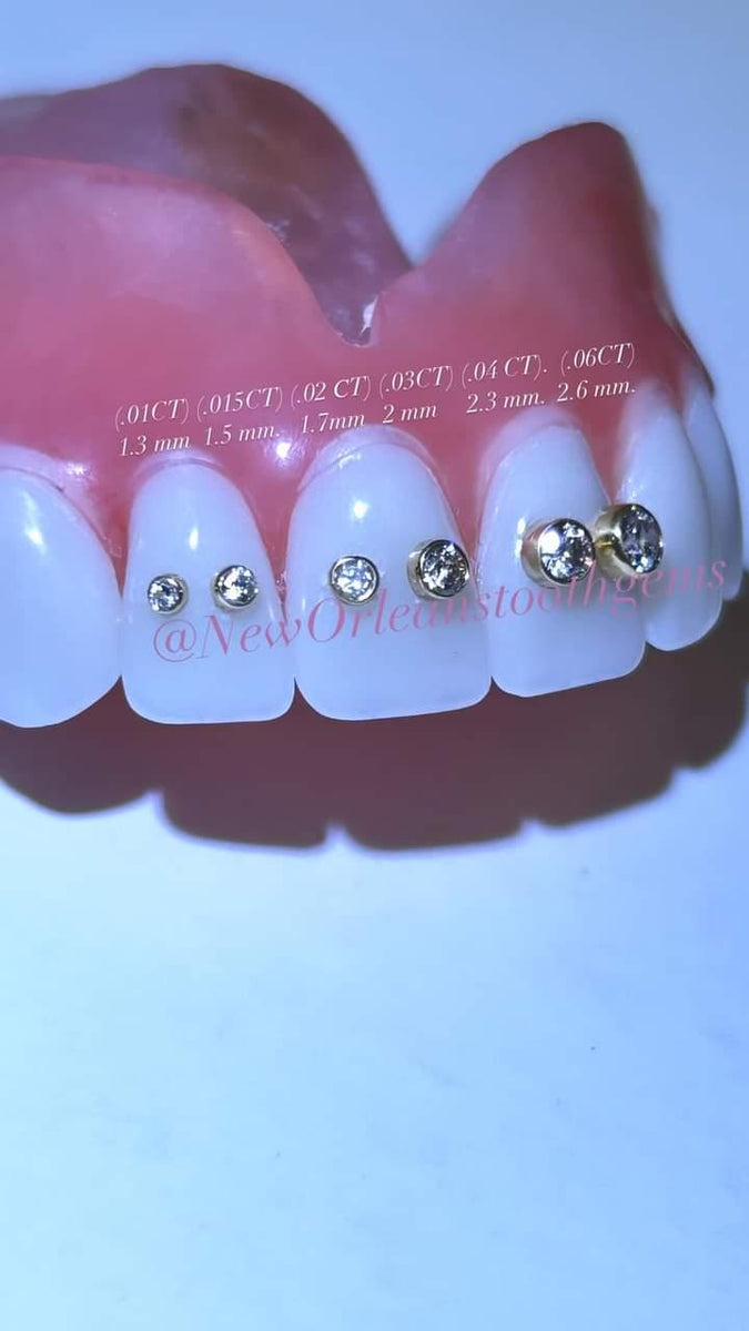 Tooth Bezel Setting Bezel Diamonds Tooth Jewelry – New Orleans Tooth Gems Www ...
